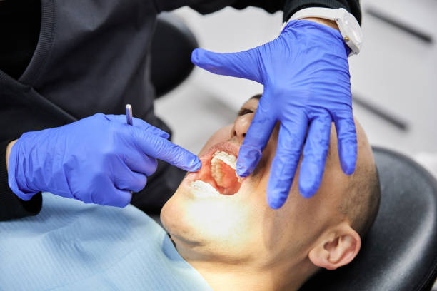 Best Emergency Wisdom Tooth Extraction in Lombard, IL